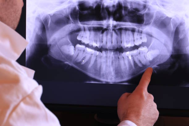Best Weekend Emergency Dentist in Hurley, WI